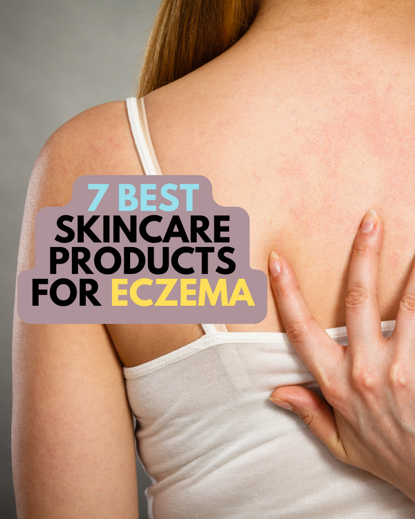 7 Best Skincare Products For Eczema
