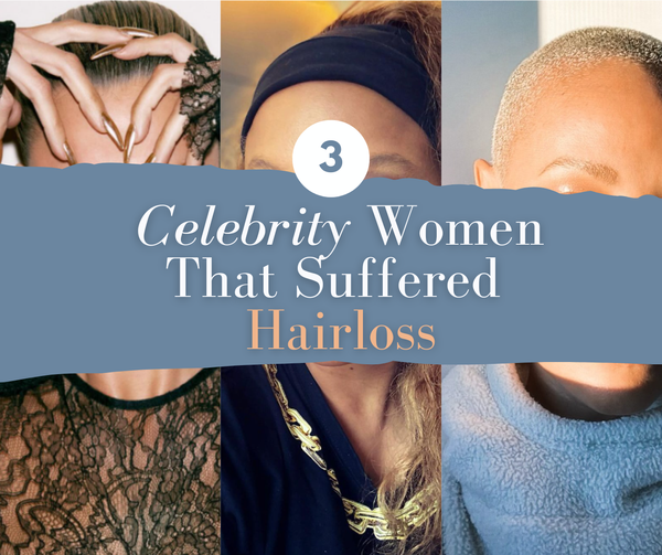 Top 3 Women Celebrity That Suffered  Hairloss - You Won't Believe It!